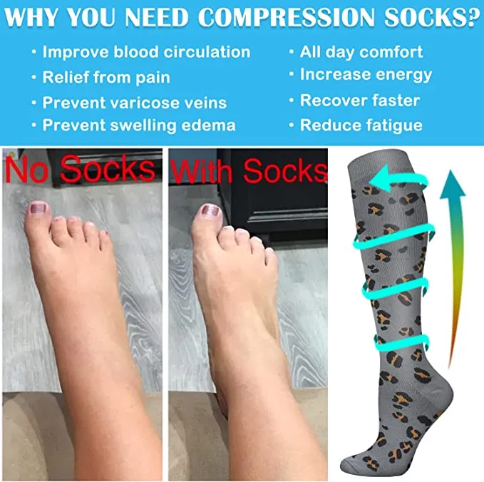 1-Pair Cool Compression Socks ( 20-30MMHG) | Actinput